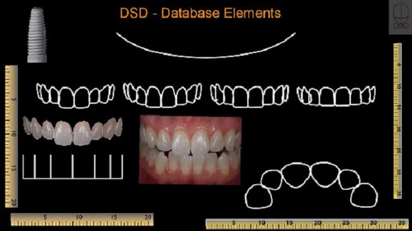 Mô phỏng hình ảnh cung răng trên DSD