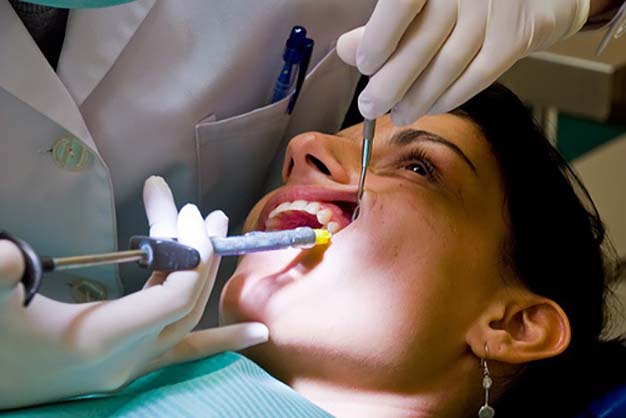 Tại sao nhổ răng bằng máy siêu âm Piezotome được ưa chuộng?