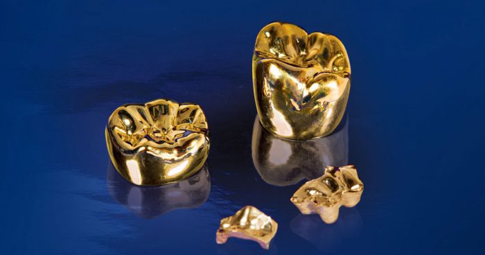 Hợp kim cao quý sẽ có lượng kim loại thuộc nhóm vàng và bạch kim chiếm trên 60%