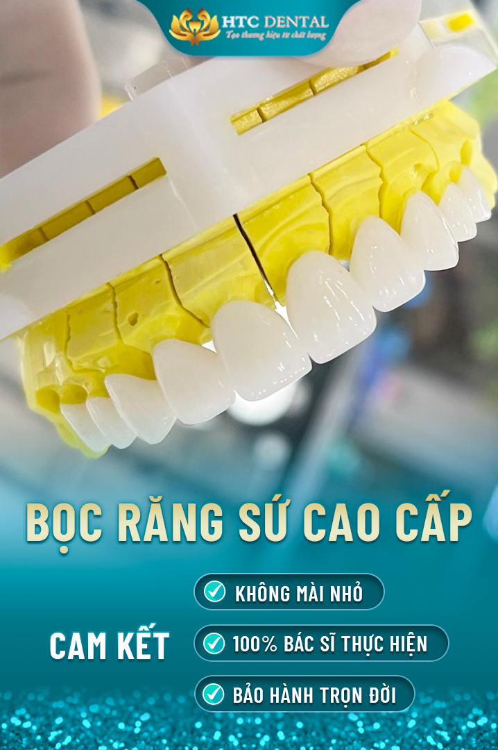 Bọc răng sứ thẩm mỹ là gì? Có nên bọc răng sứ không?