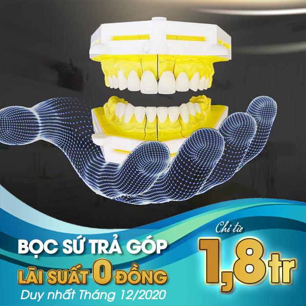 Các loại răng sứ thẩm mỹ phổ biến hiện nay – Nên chọn loại nào?