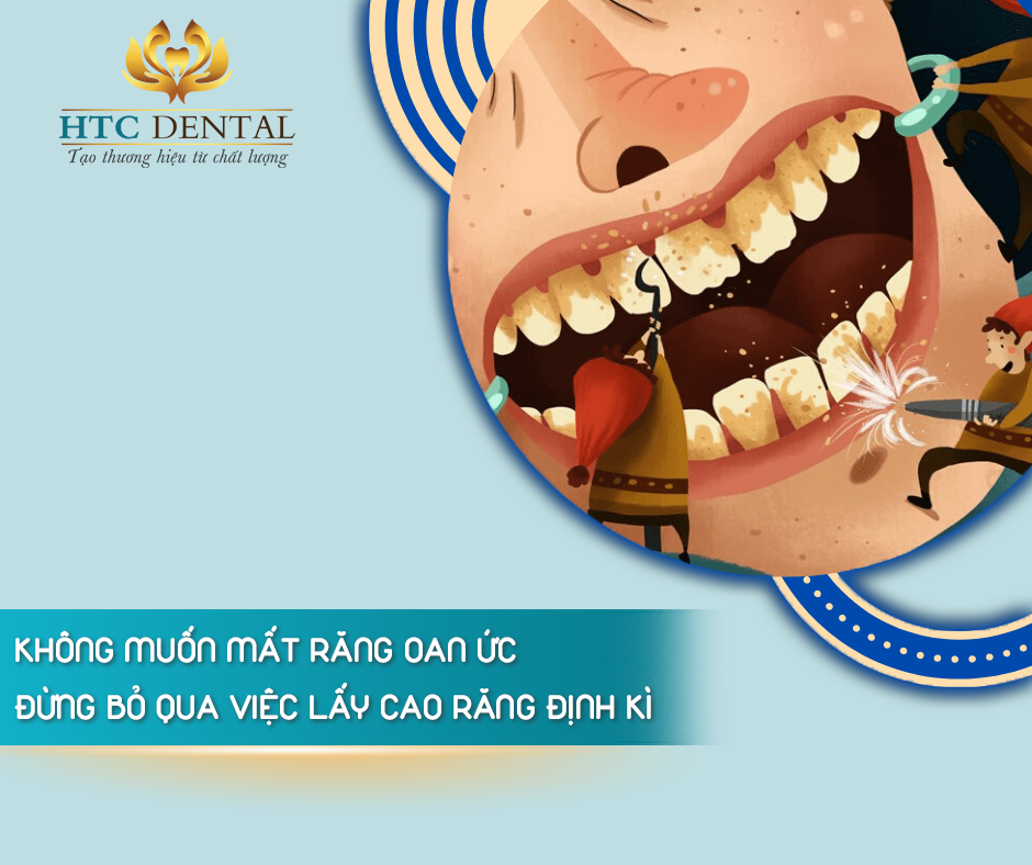 Cao răng – khởi nguồn của những rắc rối