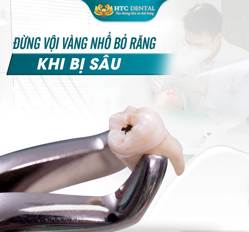 ĐỪNG VỘI VÀNG NHỔ BỎ RĂNG KHI BỊ SÂU