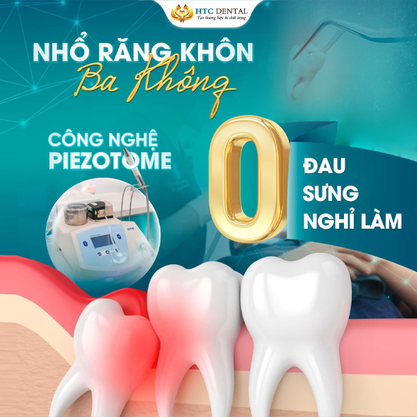 Giải pháp nào giúp bạn loại bỏ răng số 8 một cách nhẹ nhàng