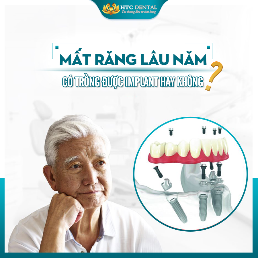 MẤT RĂNG LÂU NĂM CÓ TRỒNG ĐƯỢC IMPLANT HAY KHÔNG