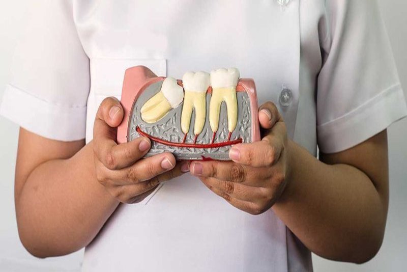 Những trường hợp nào nên nhổ răng khôn?