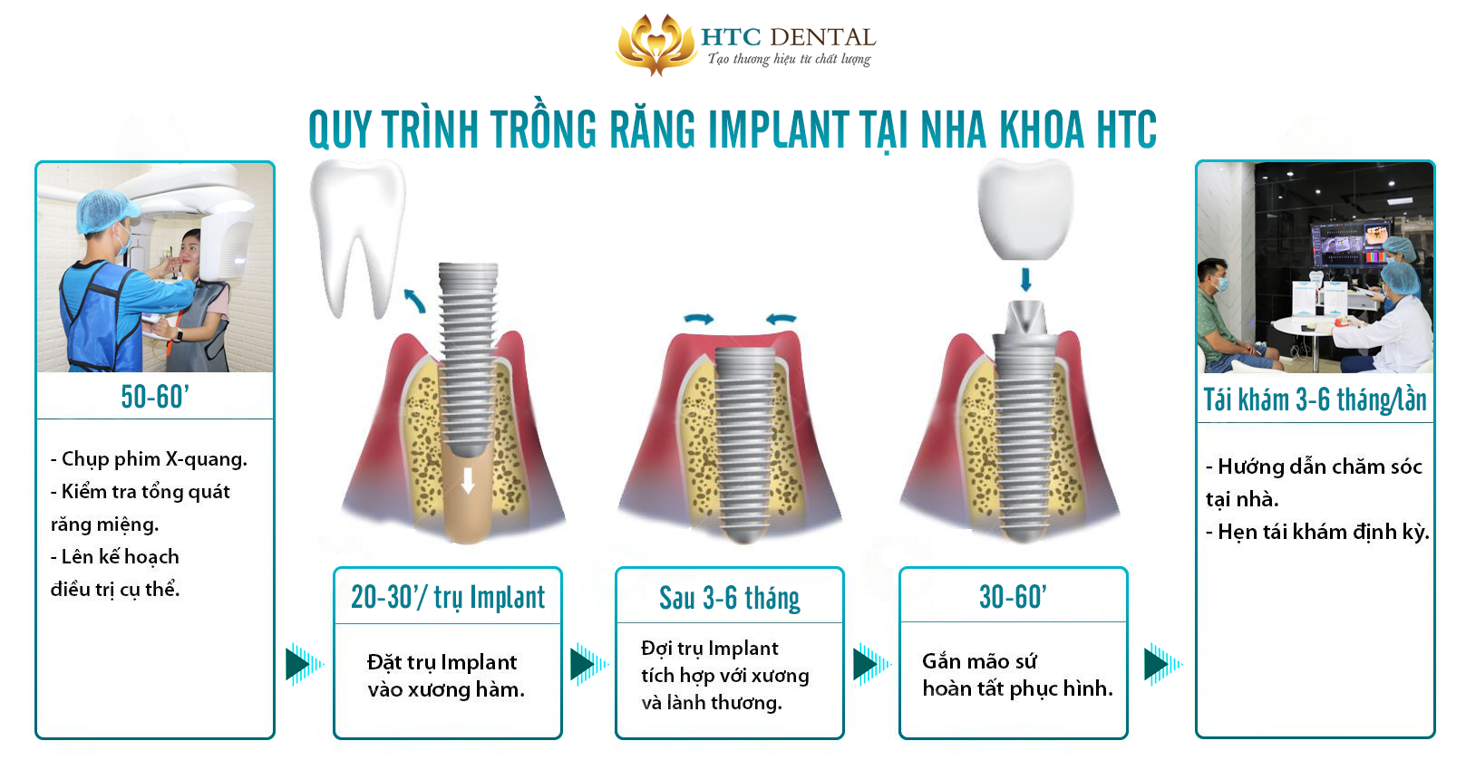 QUY TRÌNH CẤY GHÉP IMPLANT TẠI NHA KHOA HTC DIỄN RA NHƯ THẾ NÀO