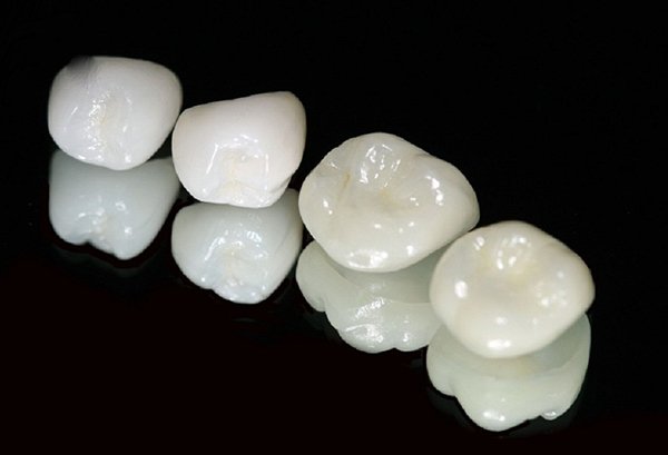Mão răng lõi Zirconia sẽ có màu sắc phù hợp với răng thật hơn