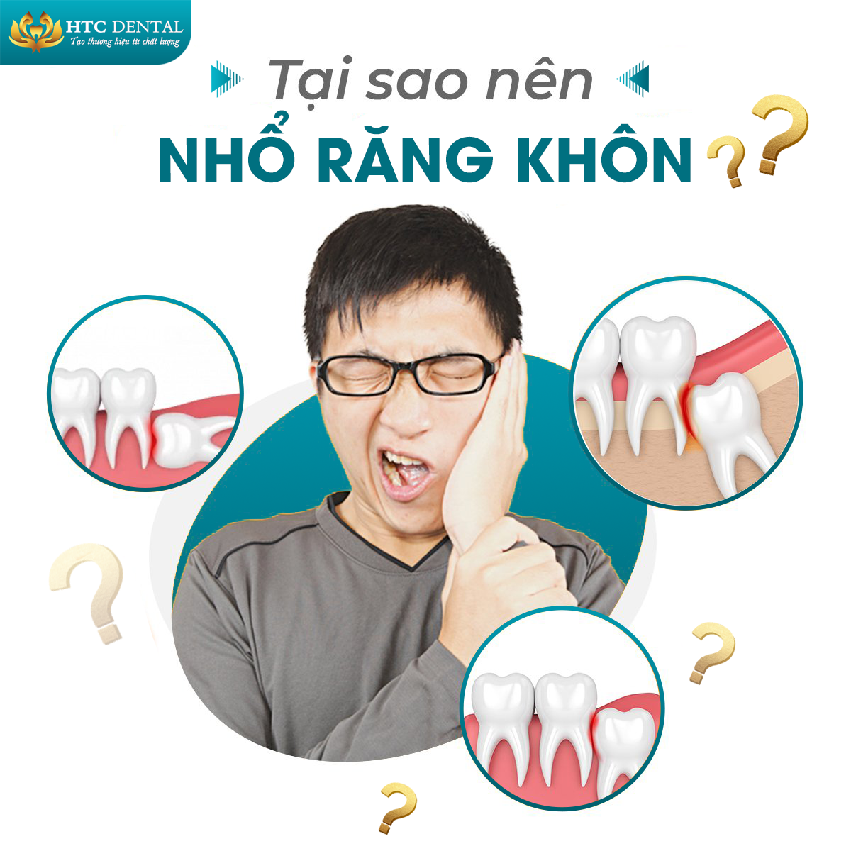 TẠI SAO NÊN NHỔ RĂNG KHÔN?