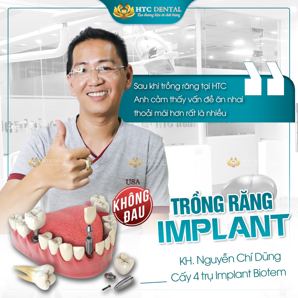 Tái tạo răng vĩnh viễn bằng công nghệ cấy ghép implant