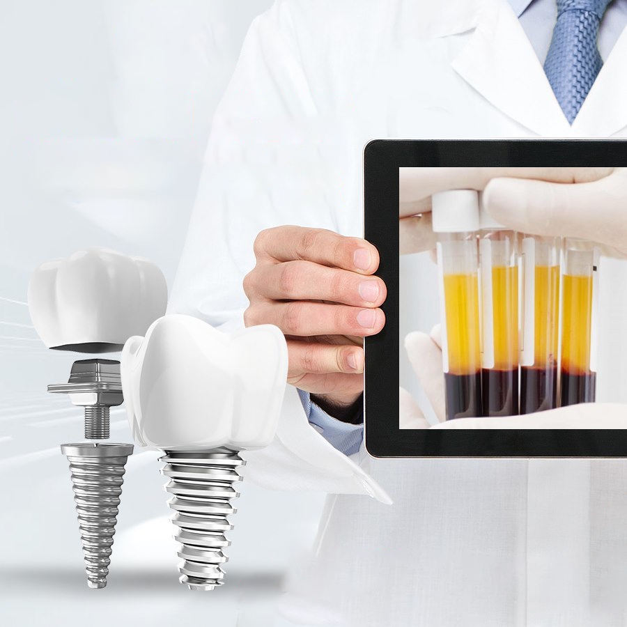 TRỒNG RĂNG IMPLANT KHÔNG ĐAU TẠI HẢI DƯƠNG – GIẢI PHÁP PHỤC HỒI RĂNG MẤT HIỆN ĐẠI NHẤT 2025