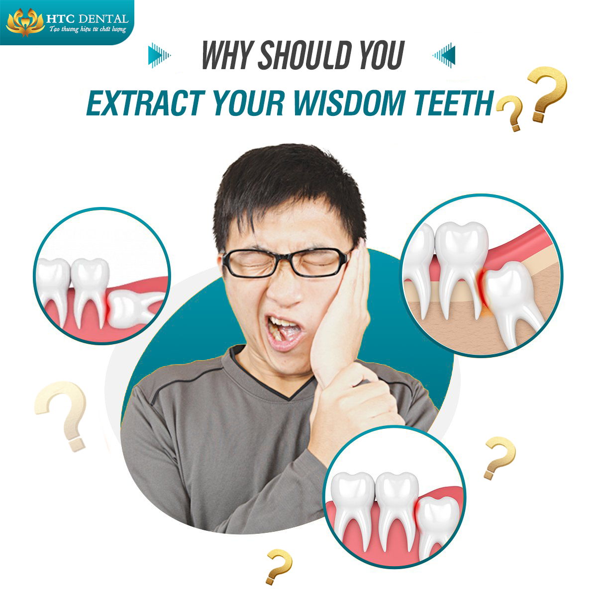 WHY SHOULD YOU EXTRACT YOUR WISDOM TEETH?